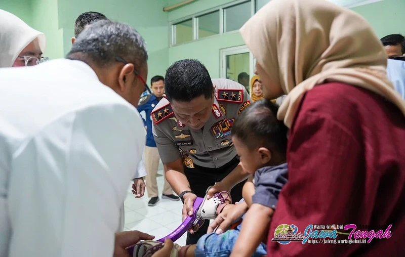 Kapolda Jateng Beri Dukungan kepada Bayi Penderita CTEV di Karanganyar