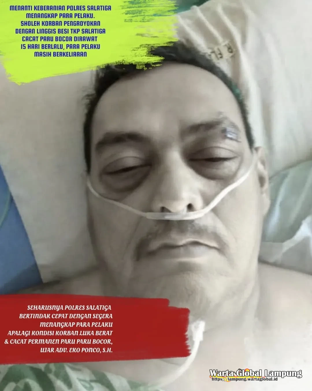 Sholeh Korban Pengroyokan Dengan Linggis Besi Kondisi Memburuk Dan Cacat Paru Bocor, Polres Salatiga Belum Menangkap Pelaku Pelaku. 15 Hari Berlalu
