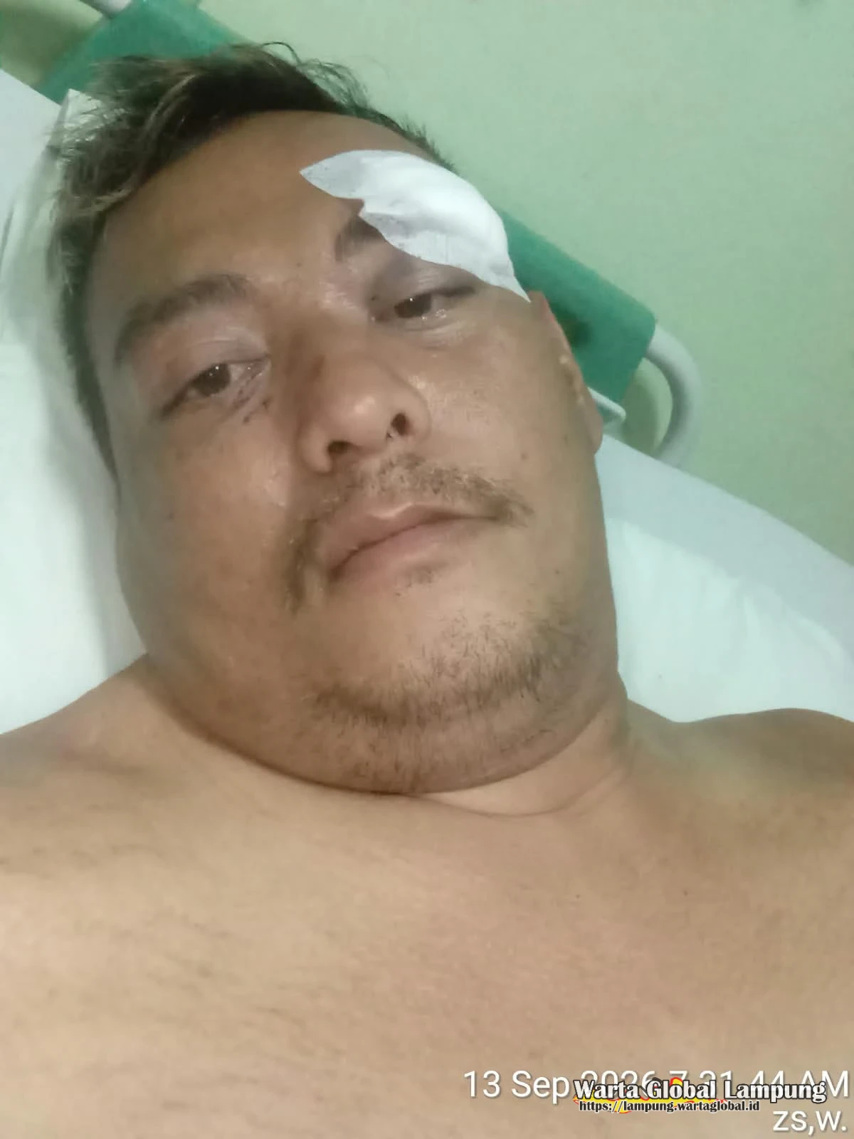 Paru Paru Bocor Diduga Akibat Hantaman Linggis bertubi tubi, Kondisi Memprihatinkan Sholeh Korban dugaan Pengroyokan Di Parkiran Benang Raja Salatiga, Polresta Salatiga Belum Menangkap Pelaku Paru Paru Bocor Diduga Akibat Hantaman Linggis bertubi tubi, Kondisi Memprihatinkan Sholeh Korban dugaan Pengroyokan Di Parkiran Benang Raja Salatiga, Polresta Salatiga Belum Menangkap Pelaku
