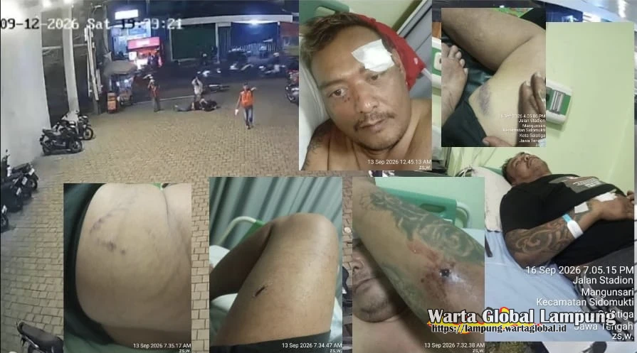 Korban Dugaan 'Pengroyokan & Percobaan Pembunuhan' dgn Linggis di Salatiga Dirawat di RSUD,Istri Lapor Polisi—FERADI WPI Tegaskan Kawal Hingga Tuntas Korban Dugaan 'Pengroyokan & Percobaan Pembunuhan' dgn Linggis di Salatiga Dirawat di RSUD,Istri Lapor Polisi—FERADI WPI Tegaskan Kawal Hingga Tuntas